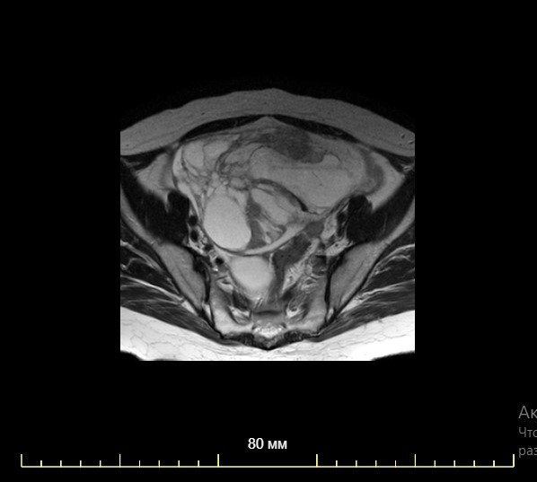 Сделать МРТ органов брюшной полости