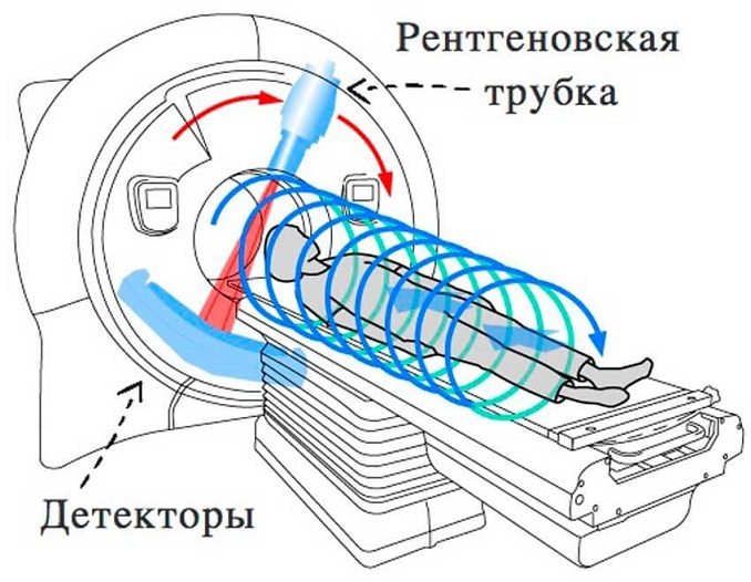 принцип работы томографа