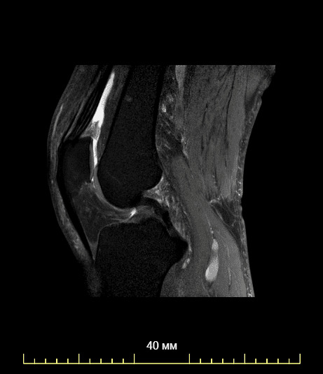 Как делают мрт коленного сустава взрослого фото сколько времени