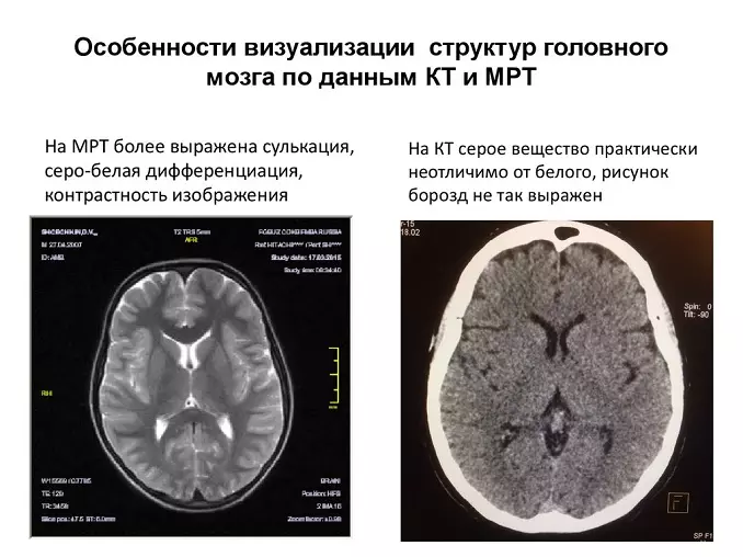 МРТ тазобедренного сустава в Новосибирске